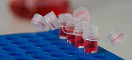 Assay kit for Mouse Anti-Neutrophil Elastase Antibody (ELISA)