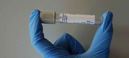 Cavy Elastin Microfibril Interface Located Protein 2 ELISA Kit[Elastin Microfibril Interface Located Protein 2]